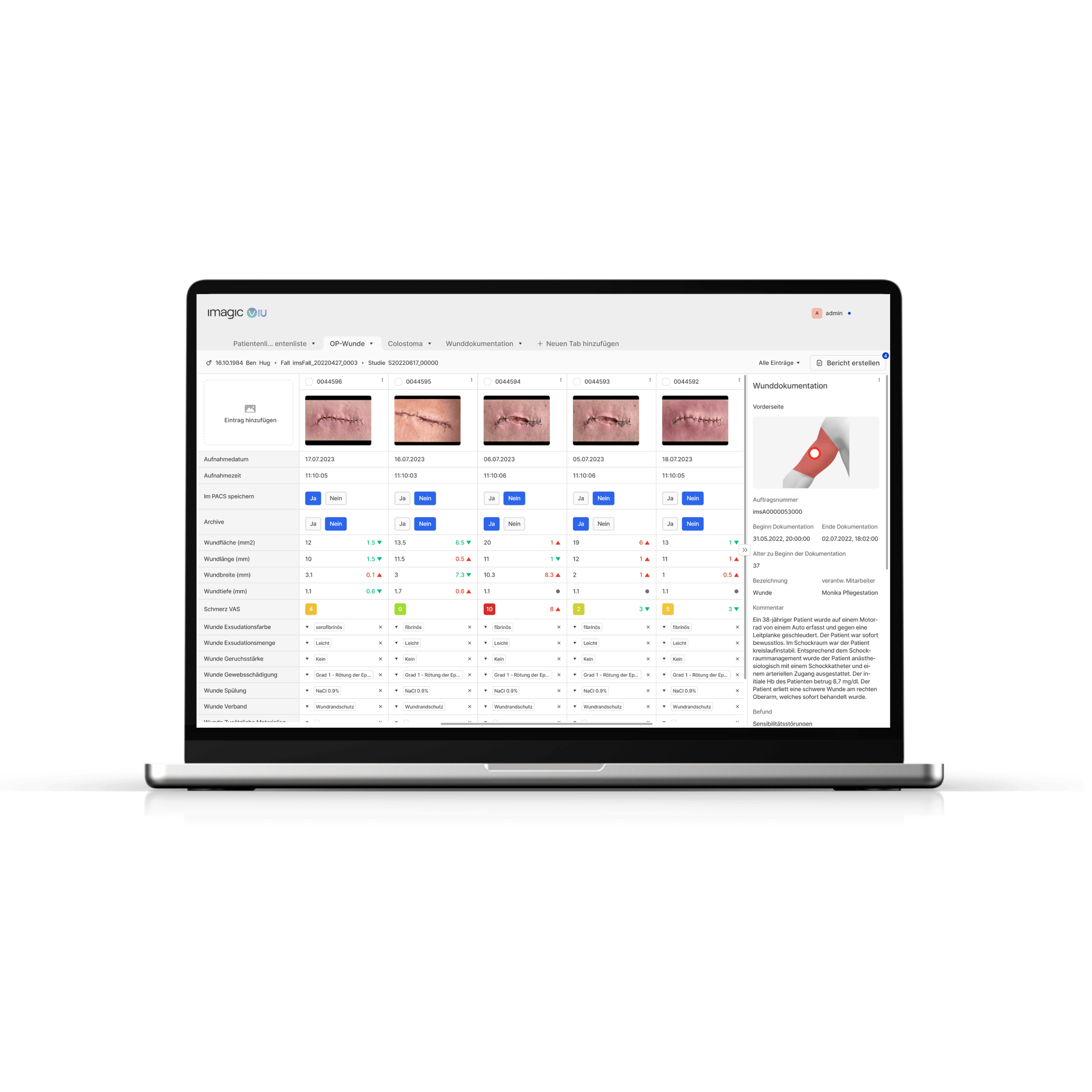 Macbook